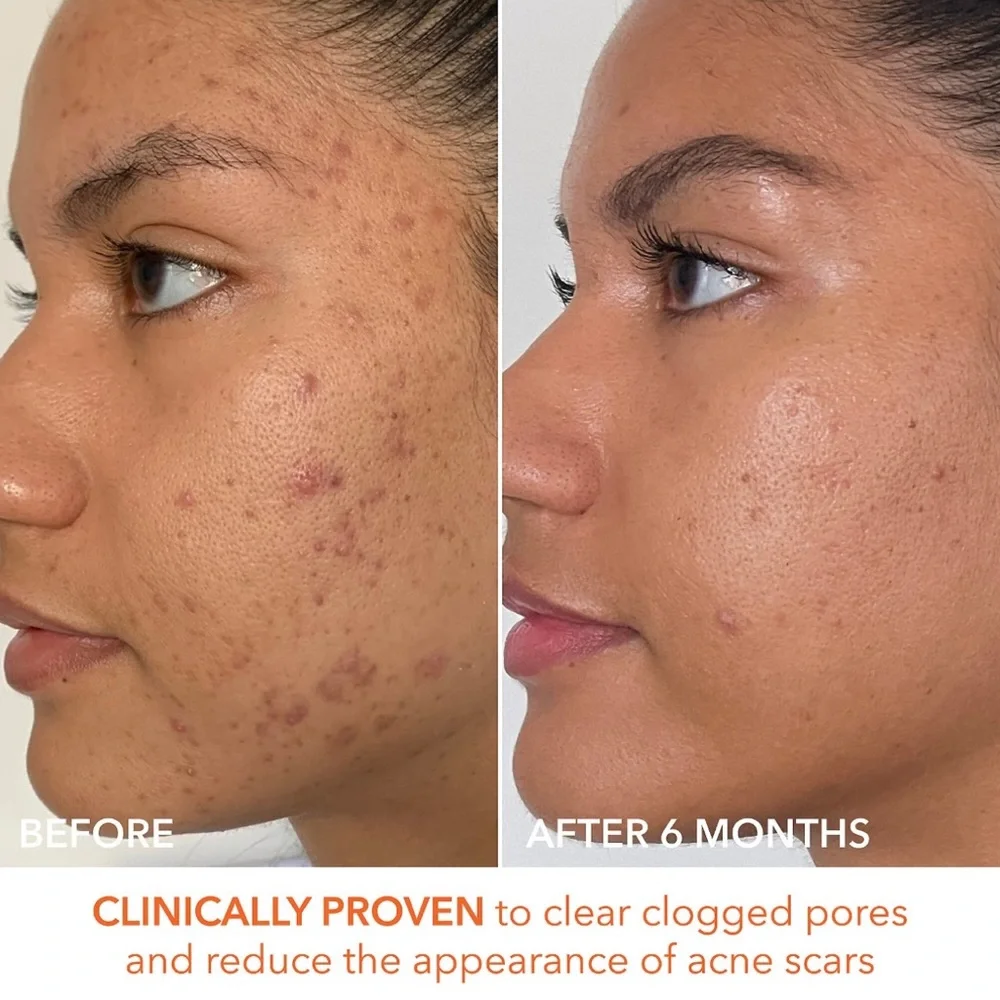 3 for $30-Dr Dennis Gross Alpha Beta Extra Strength Daily Peel Pads - Picture 8 of 16